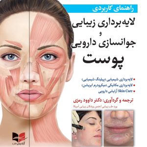 روی لایه برداری