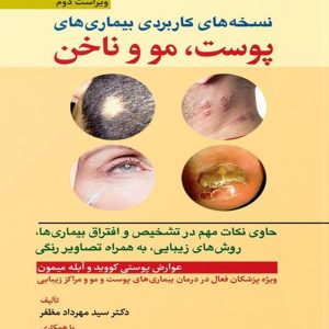 روی پوست مظفر
