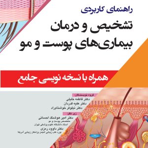 روی نسخه نویسی پوست