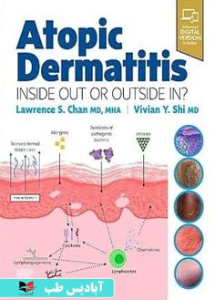 روی Atopic Dermatitis Inside Out or Outside In 1st Edition