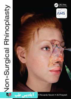 روی Non-Surgical Rhinoplasty (The PRIME Series) 1st Edition