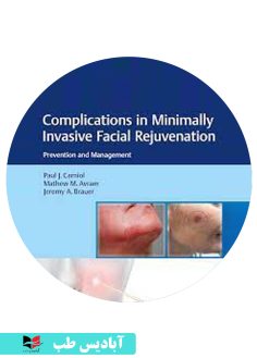 کاور سی دی Complications in Minimally Invasive Facial Rejuvenation Prevention and Management 1st Edition