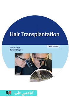 کاور سی دی Hair Transplantation 6th Edición for amazon