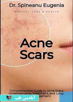 روی Comprehensive Guide to Acne Scars Understanding, Treatment, and Long-term Management (Medical care and