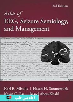 روی Atlas of EEG, Seizure Semiology, and Management 3rd Edition