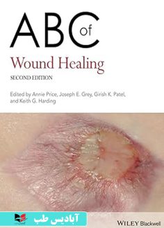 روی ABC of Wound Healing (ABC Series) 2nd Edition