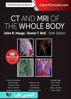 روی CT and MRI of the Whole Body, 2-Volume Set 6th Edition