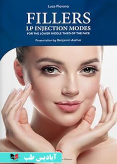 روی Fillers. LP injection modes for the lower middle third of the face