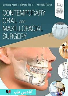 روی Contemporary Oral and Maxillofacial Surgery 7th Edition