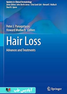 روی Hair Loss Advances and Treatments (Updates in Clinical Dermatology) 2024th Edition