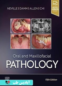 روی Oral and Maxillofacial Pathology 5th Edition