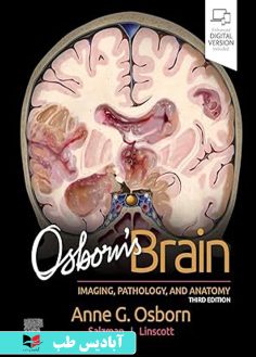 روی Osborn's Brain 3rd Edition