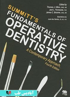 روی Summitt's Fundamentals of Operative Dentistry A Contemporary Approach 4th Edition