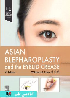 روی Asian Blepharoplasty and the Eyelid Crease 4th Edition