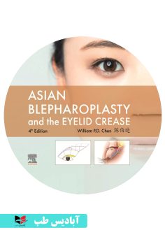 کاور سی دی Asian Blepharoplasty and the Eyelid Crease 4th Edition