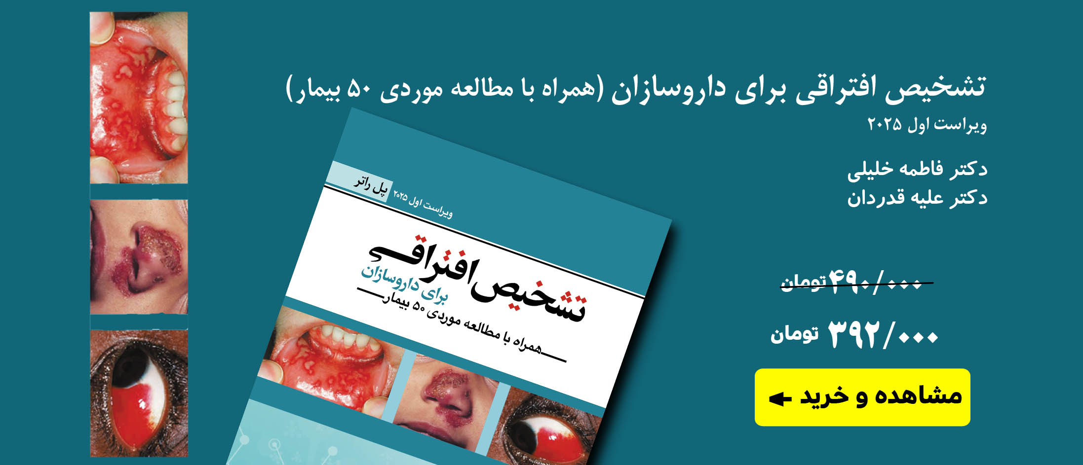 تشخیص افتراقی برای داروسازان (همراه با مطالعه موردی 50 بیمار)