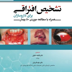 روی تشخیص افتراقی برای داروسازان (همراه با مطالعه موردی 50 بیمار)