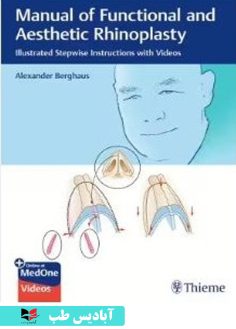 روی Manual of Functional and Aesthetic Rhinoplasty