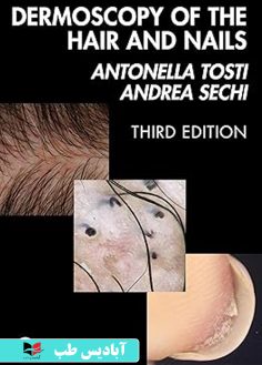 روی Dermoscopy of the Hair and Nails 3e 3rd Edition