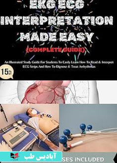 روی EKG ECG INTERPRETATION MADE EASY