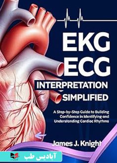 روی EKG ECG Interpretation Simplified A Step-by-Step Guide to Building Confidence in Ide