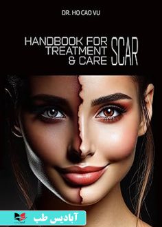 روی HANDBOOK FOR SCAR TREATMENT & CARE