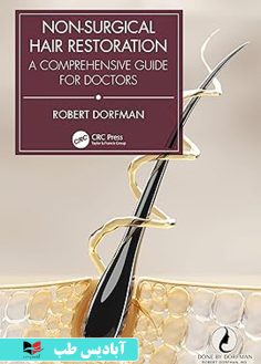 روی Non-Surgical Hair Restoration A Comprehensive Guide for Doctors 1st Edition