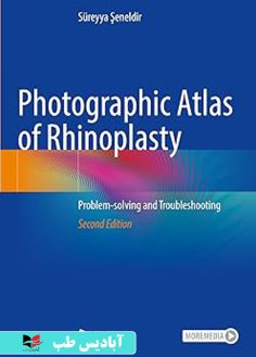 روی Photographic Atlas of Rhinoplasty Problem-solving and Troubleshooting