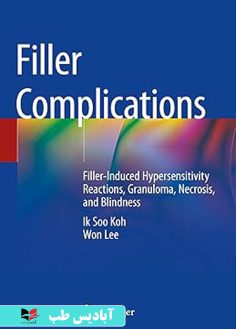 روی Filler Complications