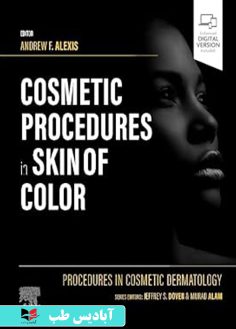 روی Procedures in Cosmetic Dermatology Cosmetic Procedures in Skin of Color 1st Edition