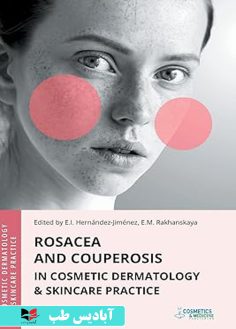 روی Rosacea and Couperosis in Cosmetic Dermatology & Skincare Practice