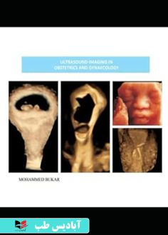 روی ULTRASOUND IMAGING IN OBSTETRICS AND GYNAECOLOGY