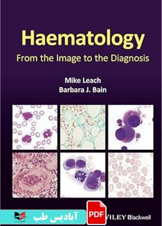 کاور محصول پی دی اف کاور محصول پی دی اف Haematology From the Image to the Diagnosis 1st Edition