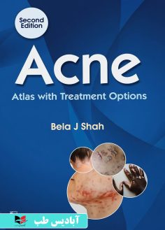 روی Acne Atlas with Treatment Options