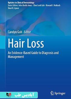 روی Hair Loss An Evidence-Based Guide to Diagnosis and Management