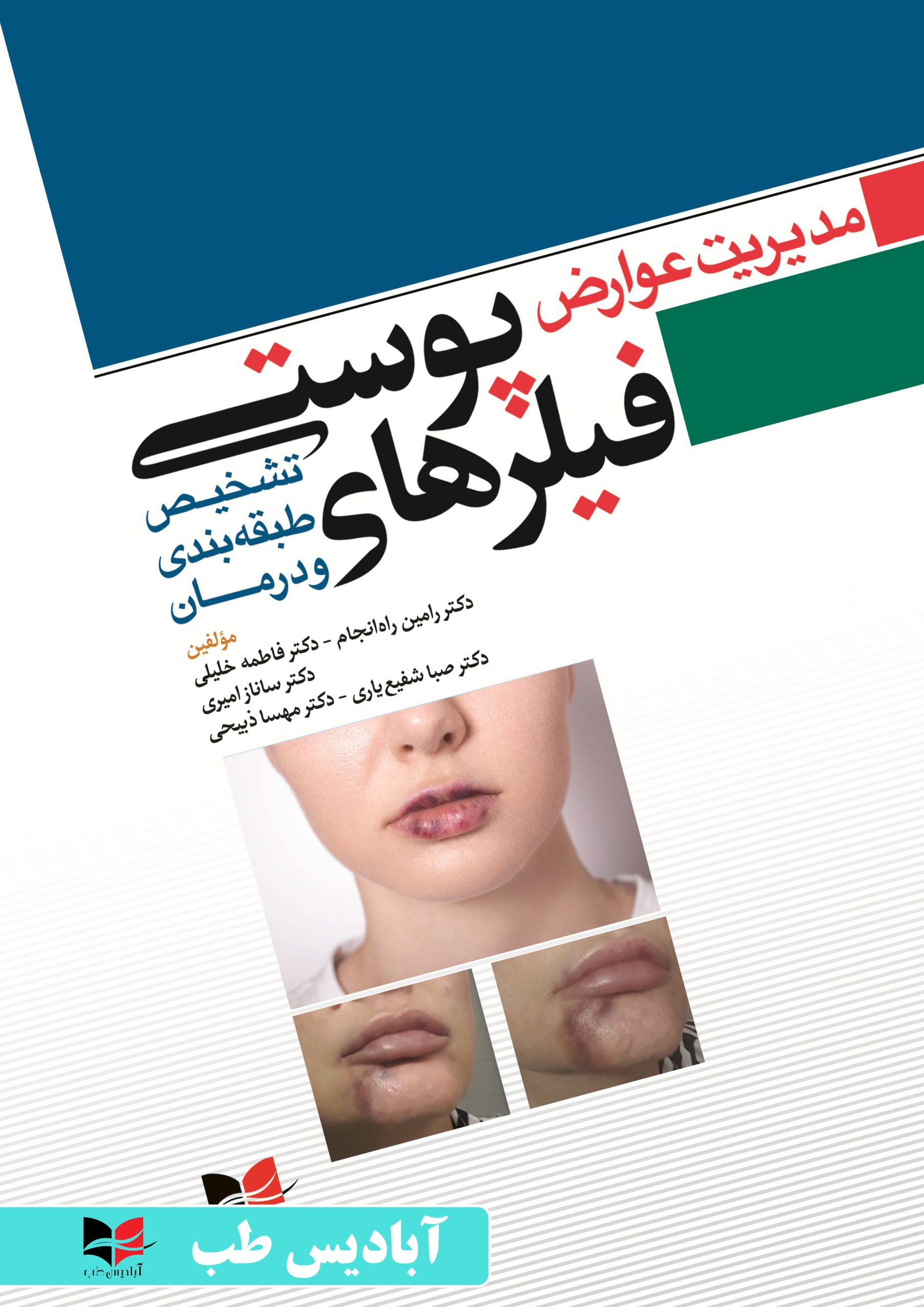 مدیریت عوارض فیلر های پوستی (تشخیص،طبقه بندی و درمان) | رامین راه انجام | فاطمه خلیلی | ساناز امیری
